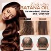 Dolahair Batana Oil for Hair Growth Organics 100% Natural Pure Batana Hair Oil Batana Oil Nourishes Damaged Hair raw Batana Butter Prevent Hair Loss Natural Hair Growth Oil and Conditioner, Beige