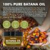 Dolahair Batana Oil for Hair Growth Organics 100% Natural Pure Batana Hair Oil Batana Oil Nourishes Damaged Hair raw Batana Butter Prevent Hair Loss Natural Hair Growth Oil and Conditioner, Beige